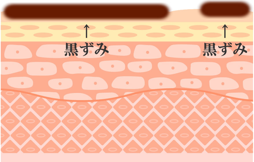 kurozumi